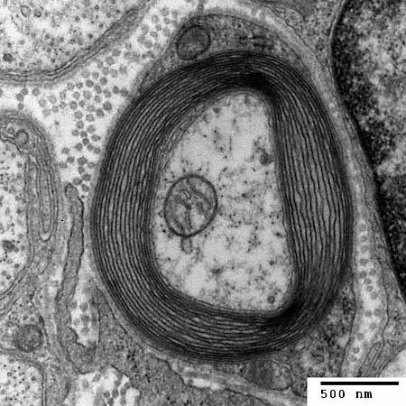 Myelin ในสมอง